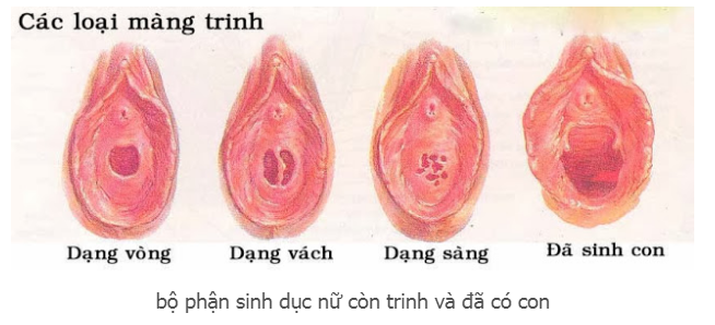 Màng trinh của nữ giới
